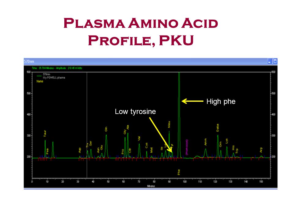 Plasma amino acids essay